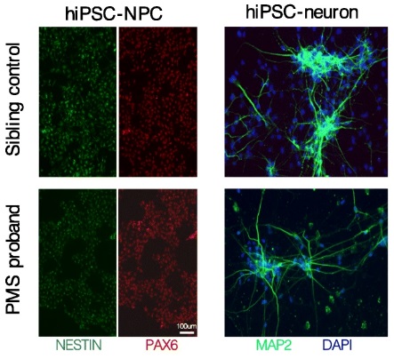 Neural Signatures in Phelan-McDermid Syndrome